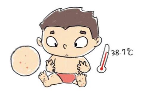 手足口病的癥狀是什么？手足口病的危害