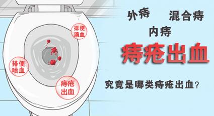昆明東大肛腸醫(yī)院專業(yè)嗎？出現(xiàn)便血，該如何分辨是哪類痔瘡出血