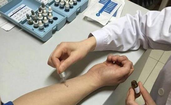 查過(guò)敏原抽哪里的血？查過(guò)敏原麻煩嗎