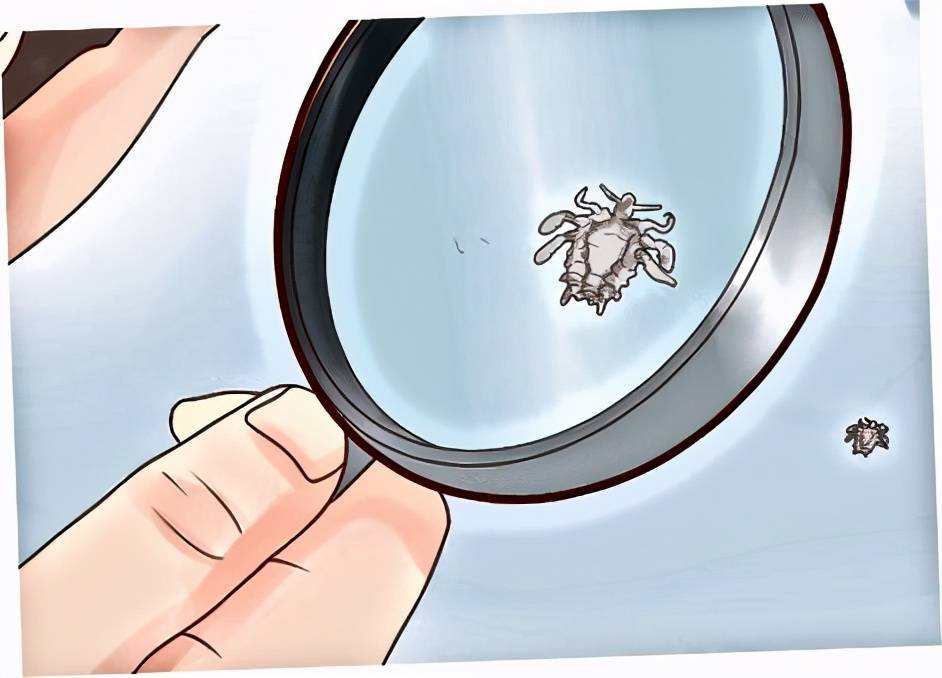 長了陰虱怎么辦？為什么會長陰虱？[圖]