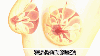 真空出門(mén)是一種什么樣體驗(yàn)？女人不穿內(nèi)衣出門(mén)什么感覺(jué)？[圖]