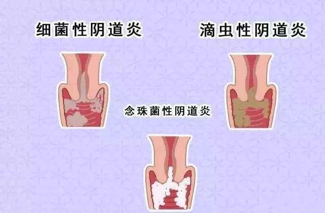 女人下面是什么樣子的圖片 陰部真實構造解剖結構圖