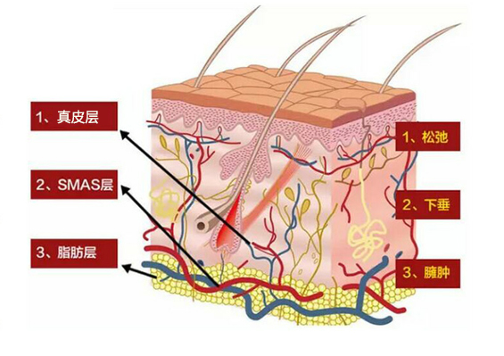 什么是赫本線？聯(lián)合麗格向淑英抗衰新理念：45°赫本線緊致術(shù)