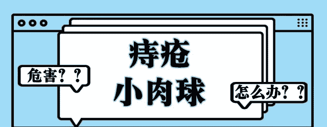 天津歐亞肛腸醫(yī)院解答：外痔瘡肉球摸著別扭，發(fā)作起來疼痛，怎么消除？