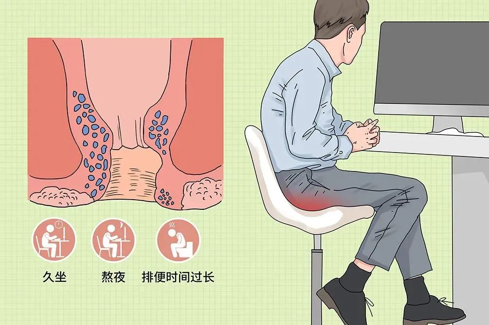 貴陽東大肛腸醫(yī)院：3分鐘教你辨別肛裂、肛瘺、痔瘡，值得收藏！