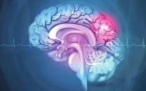 腦血栓是怎樣形成的？腦血栓如何治療？