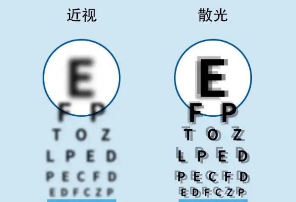 散光的癥狀有哪些？散光可以戴隱形眼鏡嗎？