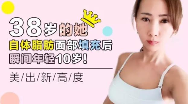 沈陽(yáng)杏林整形外科醫(yī)院行嗎 自體脂肪面部填充怎么樣