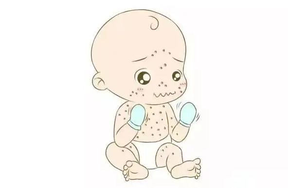 為什么會(huì)得水痘呢？得水痘有什么危害嗎？