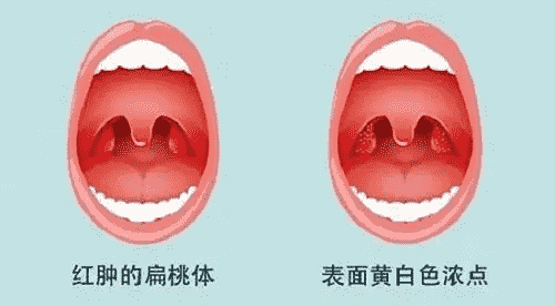 成都耳鼻喉?？婆琶詈冕t(yī)院 成都民生耳鼻喉醫(yī)院好嗎 國家三級醫(yī)院