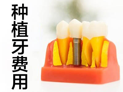 數(shù)字化種牙價錢 天津全口3d數(shù)字化種植牙的費用
