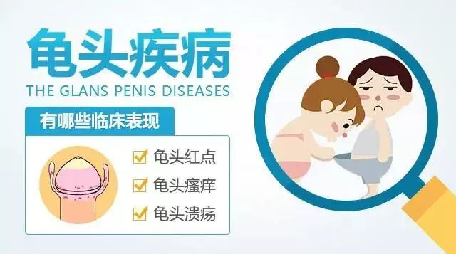  北京紫荊醫(yī)院醫(yī)生專業(yè)嗎：為什么包皮龜頭炎有異味。