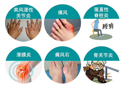 開搶|2022冬病夏治鄭州痛風(fēng)風(fēng)濕病醫(yī)院幫扶活動僅限30人！