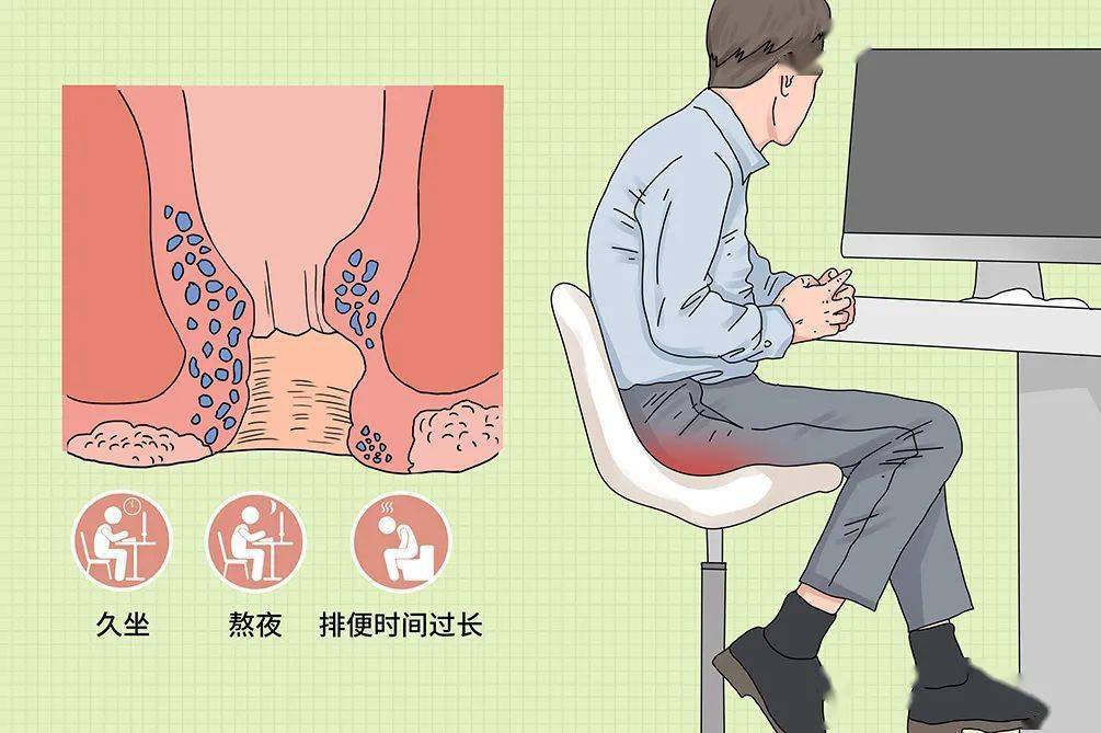 王業(yè)皇：肛瘺和痔瘡的危害各不相同，一定要及時(shí)治療。
