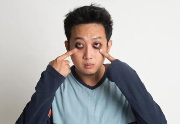 如何遮蓋黑眼圈？蘆薈膠可以去黑眼圈嗎？