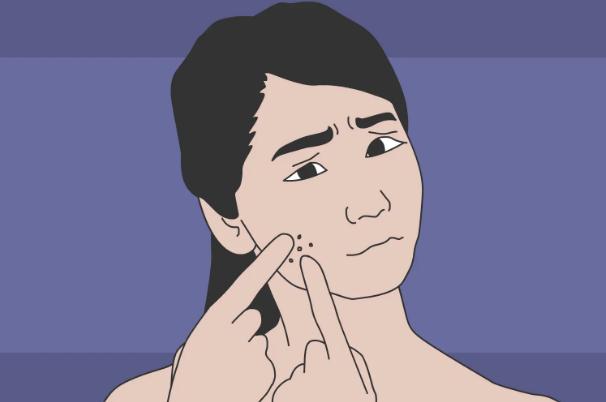 蜂蜜能治青春痘嗎？青春痘要擠掉嗎？