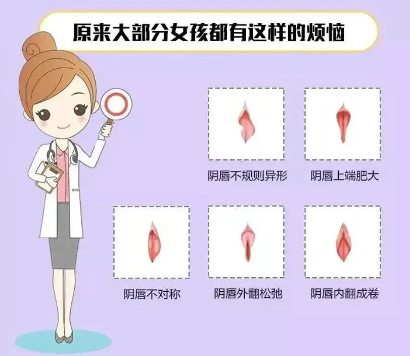 北京煤醫(yī)田秋梅：為何我的私處跟別人不一樣？怎樣才是正常的？