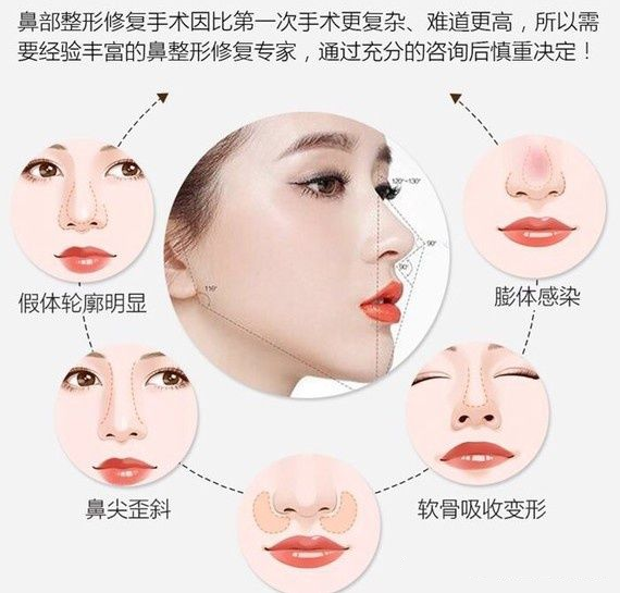 北京煤醫(yī)田秋梅：為什么鼻整形修復(fù)率越來越高越來越難做？