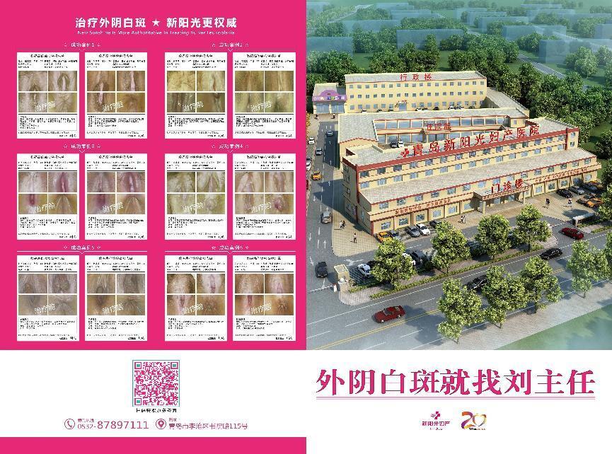  青島新陽(yáng)光婦產(chǎn)醫(yī)院：怎么自測(cè)和治療外陰白斑？
