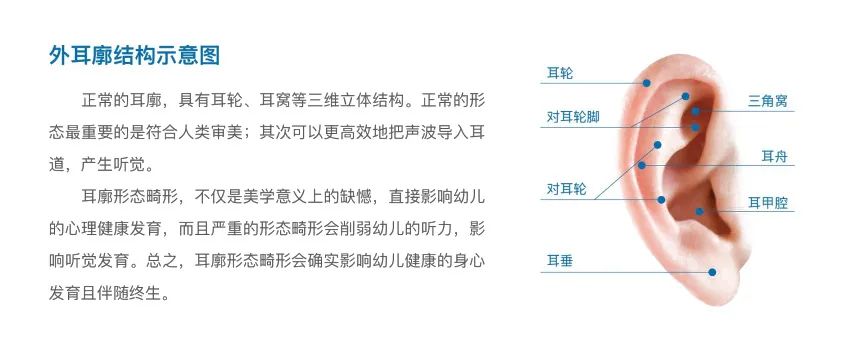 新生兒耳朵畸形怎么辦 成都民生耳鼻喉醫(yī)院 國(guó)家三級(jí)醫(yī)院 無創(chuàng)矯正