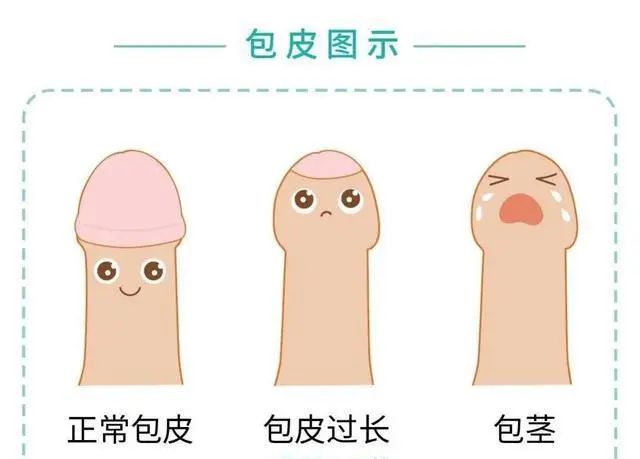 北京紫荊醫(yī)院可靠嗎？做包皮手術(shù)能治療前列腺炎？