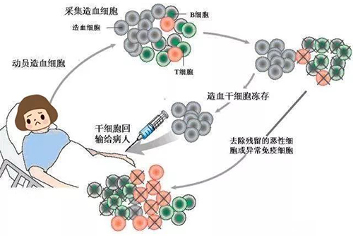 濟(jì)南血液病醫(yī)院科普：患者確診骨髓瘤應(yīng)該怎么辦？