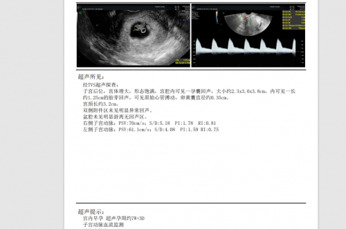 年近不惑苦求二胎，陳怡主任幫她圓夢升級