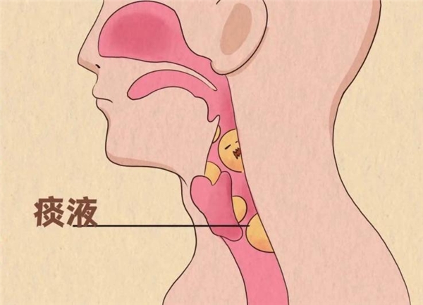新冠感染后咳不停，要怎么治療？