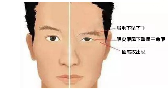 北京煤醫(yī)桂行軍：讓你更加了解雙眼皮！