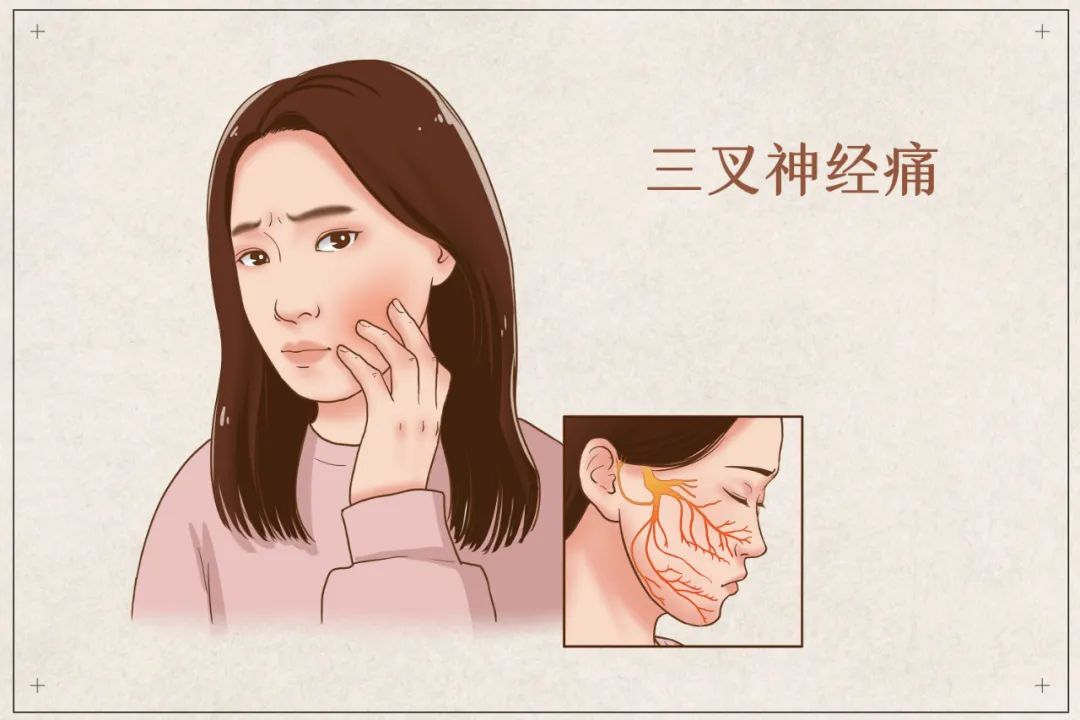 上海健橋醫(yī)院怎么樣，如何做好三叉神經(jīng)痛的預(yù)防