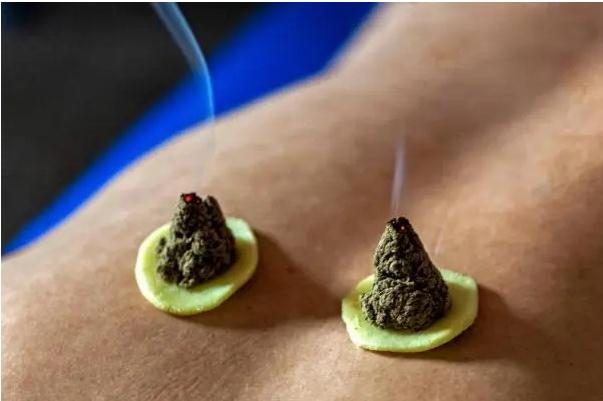 艾灸可以減肥嗎？清輕茶可以減肥嗎？