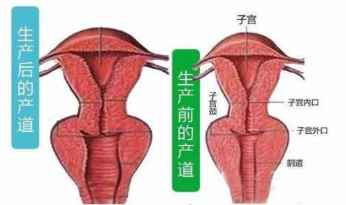 在昆明關(guān)于私密緊縮手術(shù)，你了解多少?