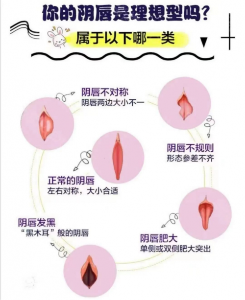 昆明做陰唇整形會留疤嗎？多久能恢復(fù)呢？
