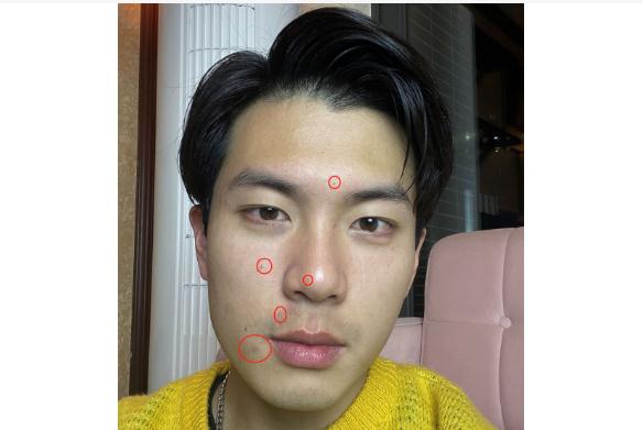 為什么男生皮膚會出油？男生皮膚出油怎么辦？