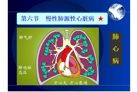 冠心病是心臟病嗎？什么是肺源性心臟??？