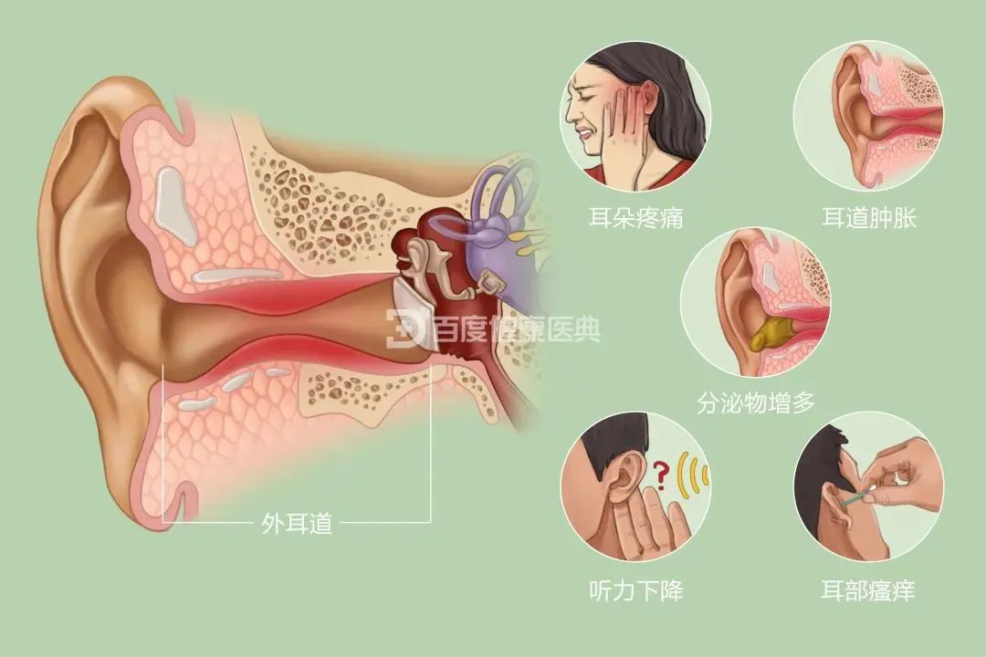兒童患”流感“為什么會耳朵疼？成都民生耳鼻喉醫(yī)院專家解答原因 國家三級醫(yī)院