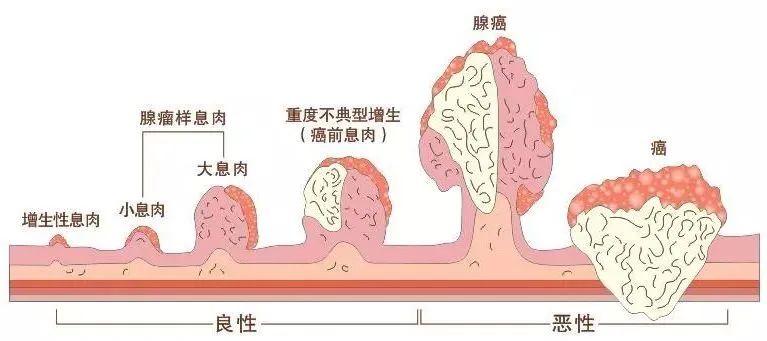  揚(yáng)州妙手醫(yī)院睡眠式無(wú)痛胃腸鏡檢查，不僅準(zhǔn)確，而且“快速”