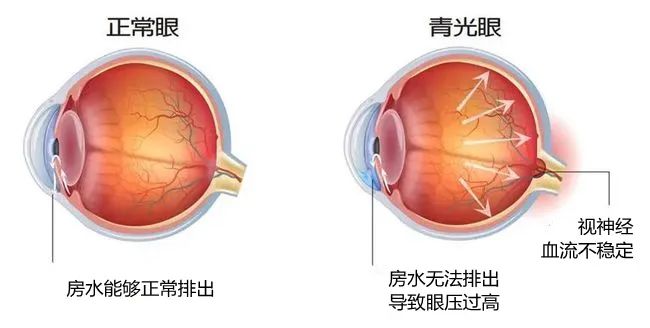 株洲愛爾代敏丨為“獨眼”女子守住最后一絲光明！