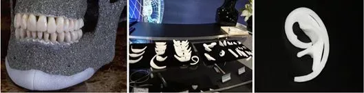北京煤醫(yī)耳畸形矯正中心：生物支架耳畸形矯正優(yōu)點(diǎn)有哪些？