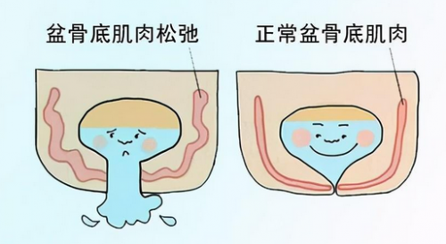 在昆明關(guān)于陰道松弛，你一定要知道的這些問題