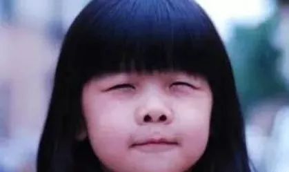 合肥愛爾：近視的人為什么喜歡瞇眼睛？瞇眼睛有哪些危害？