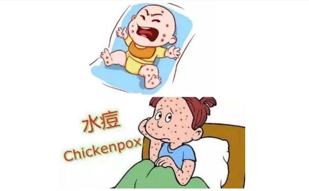 為什么會得水痘呢？出水痘應該注意什么？