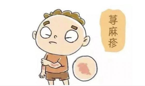 蕁麻疹是怎么得的呢？蕁麻疹與濕疹有什么區(qū)別？