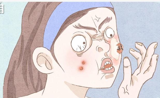 一定要了知道痘痘是如何形成的？擠痘痘的危害有什么呢？