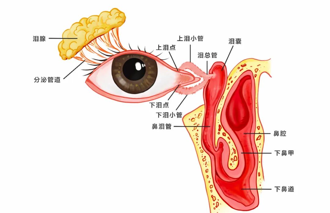 合肥愛爾眼科：女孩流淚8年？！原來是淚道堵塞！