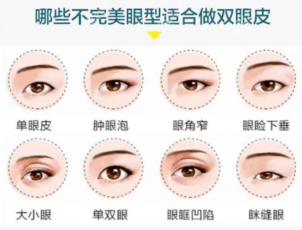 王的整形王海木：除了雙眼皮，眼整形還有哪些常見(jiàn)項(xiàng)目