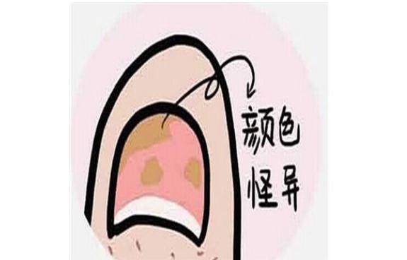 日常有灰指甲要注意什么？怎么區(qū)別灰指甲和指甲分層？