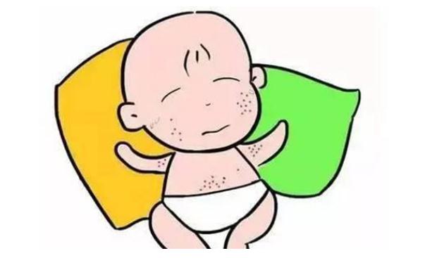 寶寶起痱子怎么止癢？爽身粉和痱子粉的區(qū)別？