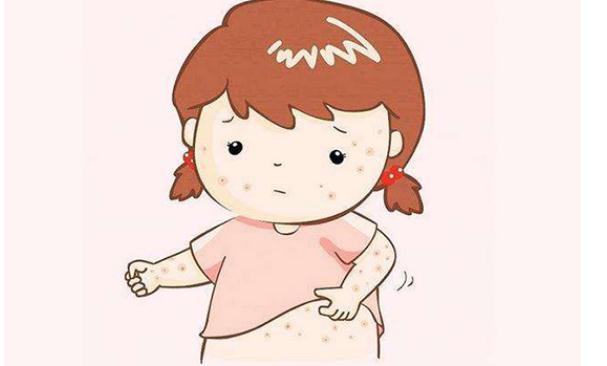 孕婦長(zhǎng)痱子如何止癢？孕婦使用痱子粉要注意什么？