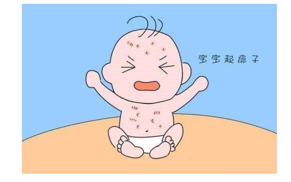 夏季如何預(yù)防寶寶長痱子？寶寶痱子有什么表現(xiàn)？